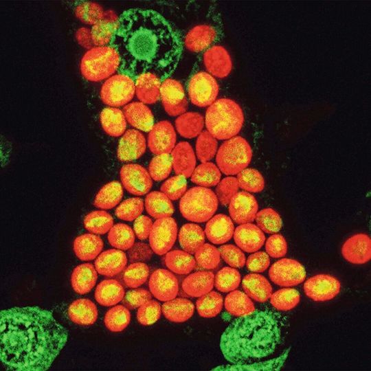 Mikroskopische Abbildung von Hydra-Epithelzellen (Zellkerne in grün), die jeweils etwa 20-30 symbiotische Chlorella-Algen enthalten (in orange). Mikroskopische Abbildung von Hydra-Epithelzellen (Zellkerne in grün), die jeweils etwa 20-30 symbiotische Chlorella-Algen enthalten (in orange).