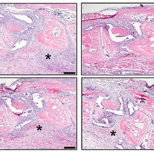 Histologische Untersuchungen von arthritischen Wildtyp-Mäusen (obere Reihe) und Mäusen mit einer Mutation des Cortisonrezeptors (GR) in nicht-Immunzellen. ... (Ausschnitt) Histologische Untersuchungen von arthritischen Wildtyp-Mäusen (obere Reihe) und Mäusen mit einer Mutation des Cortisonrezeptors (GR) in nicht-Immunzellen. ... (Ausschnitt)