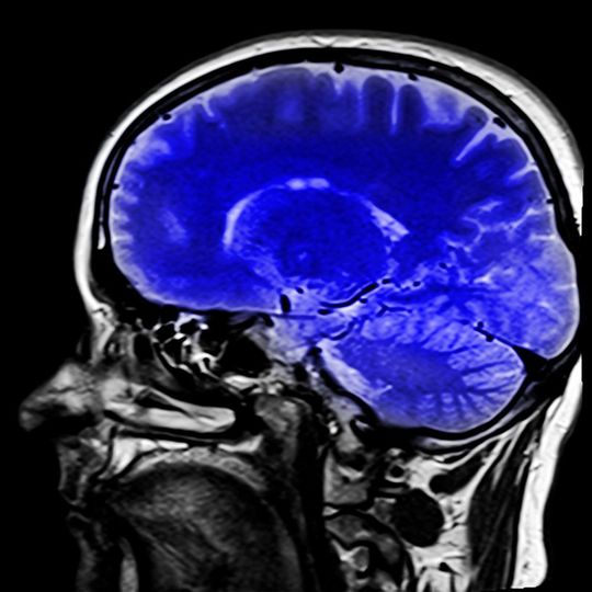 Aufschiber oder MAcher? Mittels Kernspintomografie identifizierten Forscher der Ruhr-Universität Bochum (RUB) zwei Hirnbereiche, deren Größe und funktionelle Verknüpfung damit zusammenhängt, wie gut eine Person ihre Handlungen kontrollieren kann. (Symbolbild) Aufschiber oder MAcher? Mittels Kernspintomografie identifizierten Forscher der Ruhr-Universität Bochum (RUB) zwei Hirnbereiche, deren Größe und funktionelle Verknüpfung damit zusammenhängt, wie gut eine Person ihre Handlungen kontrollieren kann. (Symbolbild)