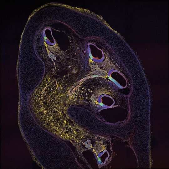 Menschliche Cochlea nach zehn Wochen Entwicklungszeit, immungefärbt zur Identifizierung von Haarzellenvorläufern: „CD271“ in gelb, „p27“ in grün.