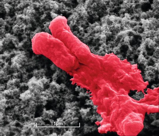 Hier zu sehen: Eine Antibiotikabeschichtung lysiert ein E-Coli-Bakterium. Auf der Compamed stellen die Forscher der Fraunhofer-Institute ihre Lösung vor. Hier zu sehen: Eine Antibiotikabeschichtung lysiert ein E-Coli-Bakterium. Auf der Compamed stellen die Forscher der Fraunhofer-Institute ihre Lösung vor.