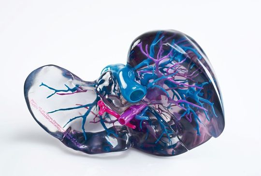 Durch die Verwendung von komplexen 3D-gedruckten Modellen vor der Operation erzielt die Klinik für Herz-, Thorax- und Gefäßchirurgie der Universitätsmedizin der Johannes Gutenberg-Universität Mainz bei lebensbedrohenden Aortaoperationen eine Zeitersparnis von bis zu 40 Prozent. Durch die Verwendung von komplexen 3D-gedruckten Modellen vor der Operation erzielt die Klinik für Herz-, Thorax- und Gefäßchirurgie der Universitätsmedizin der Johannes Gutenberg-Universität Mainz bei lebensbedrohenden Aortaoperationen eine Zeitersparnis von bis zu 40 Prozent.