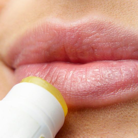 Zu den acht bekannten menschlichen Herpesviren gehören unter anderen das Herpes-simplex-Virus, das die bekannten Bläschen im Mundbereich verursacht. (Symbolbild) Zu den acht bekannten menschlichen Herpesviren gehören unter anderen das Herpes-simplex-Virus, das die bekannten Bläschen im Mundbereich verursacht. (Symbolbild)