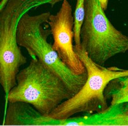 Göttinger Forscher entwickelten eine neue Methode, mit der die im Bindegewebe der Niere verborgenen Fibroblasten (grün) gezielt von krankheitsverursachenden epigenetischen Veränderungen (orange) gesäubert werden können. Göttinger Forscher entwickelten eine neue Methode, mit der die im Bindegewebe der Niere verborgenen Fibroblasten (grün) gezielt von krankheitsverursachenden epigenetischen Veränderungen (orange) gesäubert werden können.