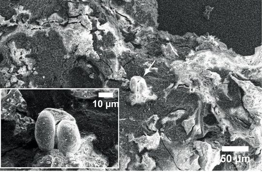 Rasterelektronenmikroskopisches Bild der mikroskopischen Struktur der Lebensmittelkruste vom Rand des historischen Topfes, in dem Karpfen-Kaviar gefunden wurde. Pflanzenreste (mit verkrusteten Nadelbaumpollen) deuten darauf hin, dass der Topf wahrscheinlich während des Kochvorgangs mit Blättern bedeckt war. Rasterelektronenmikroskopisches Bild der mikroskopischen Struktur der Lebensmittelkruste vom Rand des historischen Topfes, in dem Karpfen-Kaviar gefunden wurde. Pflanzenreste (mit verkrusteten Nadelbaumpollen) deuten darauf hin, dass der Topf wahrscheinlich während des Kochvorgangs mit Blättern bedeckt war.