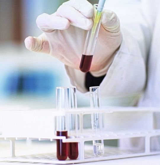 Wie beurteilen privatwirtschaftliche Laboratorien den Akkreditierungsaufwand? Eine Dezember-Umfrage unter den VUP-Mitgliedsunternehmen zeigt deren Einschätzung (Symbolbild). Wie beurteilen privatwirtschaftliche Laboratorien den Akkreditierungsaufwand? Eine Dezember-Umfrage unter den VUP-Mitgliedsunternehmen zeigt deren Einschätzung (Symbolbild).