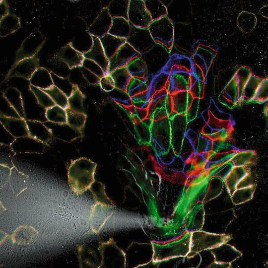 Forscher haben die molekulare Kraftübertragung in Desmosomen, den Verknüpfungspunkten von Hautzellen bestimmt: Vor (blau), während (grün) und nach (rot) der Anwendung mechanischen Stresses. Forscher haben die molekulare Kraftübertragung in Desmosomen, den Verknüpfungspunkten von Hautzellen bestimmt: Vor (blau), während (grün) und nach (rot) der Anwendung mechanischen Stresses.
