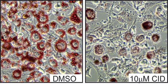 Fettzellen, die während ihrer Differenzierung mit einem PKD-Hemmstoff behandelt wurden (Abbildung rechts), speichern sehr viel weniger Fetttröpfchen (rot) als unbehandelte Zellen (Abbildung links). Fettzellen, die während ihrer Differenzierung mit einem PKD-Hemmstoff behandelt wurden (Abbildung rechts), speichern sehr viel weniger Fetttröpfchen (rot) als unbehandelte Zellen (Abbildung links).