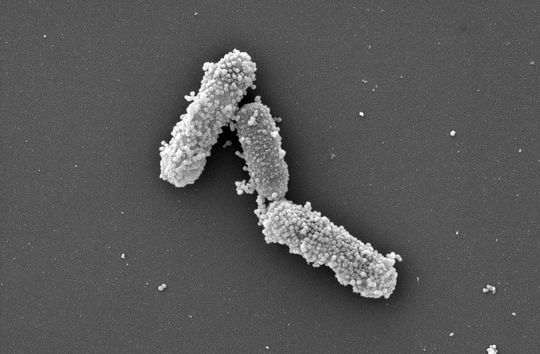 Elektronenmikroskopische Aufnahme von Darmbakterien mit angelagerten Nanopartikeln