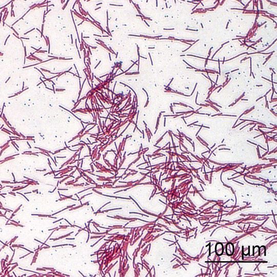 Lichtmikroskopische Aufnahme von Clostridium ramosum nach Gram-Färbung Lichtmikroskopische Aufnahme von Clostridium ramosum nach Gram-Färbung
