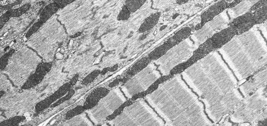 Electron microscopy of a knockout in which the smallest contractive units in the muscle (sarcomeres) fall apart. "On the right you can see the heart of a mouse that only produced a shortened titin, in which the end of the protein can no longer be properly anchored and whose heart was thus reduced in size (atrophic)."