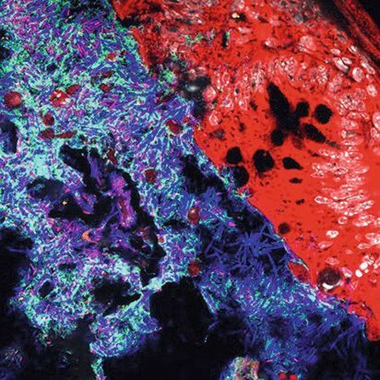 Mucispirillum (grün) und Salmonella (pink) im Darmlumen von Mäusen. Andere Bakterien sind in blau, das Darmepithel in rot dargestellt. Mucispirillum (grün) und Salmonella (pink) im Darmlumen von Mäusen. Andere Bakterien sind in blau, das Darmepithel in rot dargestellt.