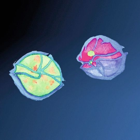 Aquarellbild eines gesunden Dinoflagellaten Alexandrium (links) und eines von Amoebophrya befallenen (rechts). Aquarellbild eines gesunden Dinoflagellaten Alexandrium (links) und eines von Amoebophrya befallenen (rechts).