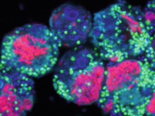 Legionellen (pink eingefärbt) vermehren sich bevorzugt in Amöben (hellblau). Diese ca. 50 µm großen Einzeller beherbergen häufig bakterielle Endosymbionten (grün), die das Wachstum der Legionellen hemmen. Auf diese Weise schützen sie die Amöben und tragen zur Reduktion der Verbreitung der Legionellen in der Umwelt bei. Legionellen (pink eingefärbt) vermehren sich bevorzugt in Amöben (hellblau). Diese ca. 50 µm großen Einzeller beherbergen häufig bakterielle Endosymbionten (grün), die das Wachstum der Legionellen hemmen. Auf diese Weise schützen sie die Amöben und tragen zur Reduktion der Verbreitung der Legionellen in der Umwelt bei.