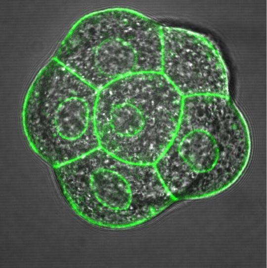 Einzelne embyonale Zellen werden durch ihre Zellmembranen (grün) dargestellt. Der kleine innere Kreis zeigt die Kernlamelle, in dem sich das Genom befestigt. Einzelne embyonale Zellen werden durch ihre Zellmembranen (grün) dargestellt. Der kleine innere Kreis zeigt die Kernlamelle, in dem sich das Genom befestigt.