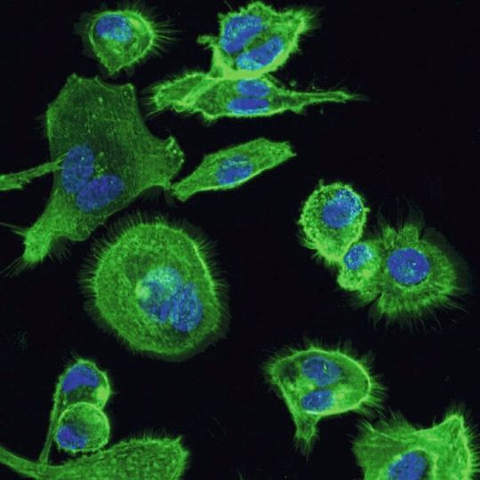 Diese Immunzellen exprimieren den HCA3-Rezeptor, der nur bei Menschanaffen und Menschen vorkommt. Kern und Cytoskelett sind gefärbt. Diese Immunzellen exprimieren den HCA3-Rezeptor, der nur bei Menschanaffen und Menschen vorkommt. Kern und Cytoskelett sind gefärbt.