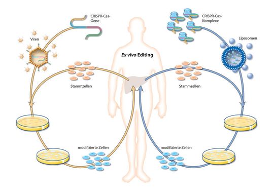 Bei der sogenannten „ex vivo“ Genom Editierung werden dem Körper zunächst Stammzellen entnommen und deren Erbgut verändert. Dies geschieht entweder über genetisch veränderte Viren, die in ihrem Genom die Gene für CRISPR Cas9 besitzen und die diese Gene ins Erbgut der Stammzellen einbauen. Die modifizierten Zellen können sich dann im Körper vermehren. Alternativ werden die fertigen Moleküle des CRISPR-Cas-Systems in kleine Fetttröpfchen (Liposomen) verpackt, die von den Stammzellen aufgenommen werden. Bei der sogenannten „ex vivo“ Genom Editierung werden dem Körper zunächst Stammzellen entnommen und deren Erbgut verändert. Dies geschieht entweder über genetisch veränderte Viren, die in ihrem Genom die Gene für CRISPR Cas9 besitzen und die diese Gene ins Erbgut der Stammzellen einbauen. Die modifizierten Zellen können sich dann im Körper vermehren. Alternativ werden die fertigen Moleküle des CRISPR-Cas-Systems in kleine Fetttröpfchen (Liposomen) verpackt, die von den Stammzellen aufgenommen werden.