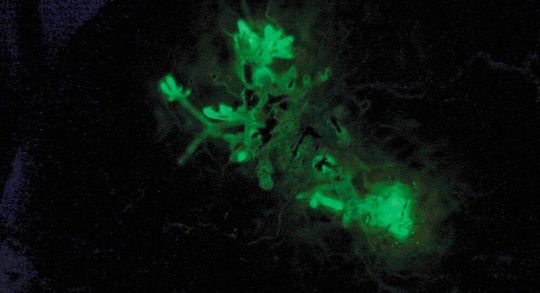 Der herbe Zwergknäueling gehört weltweit zu den 71 Pilzarten, die im Dunklen leuchten. Er kommt u.a. in deutschen Laub- und Mischwäldern vor allem auf totem Eichenholz vor.