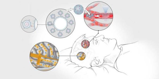 Noch Zukunftsvision – Mikrochips auf der Grosshirnrinde messen Hirnaktivitäten und aktivieren gezielt notwendige Medikamente.