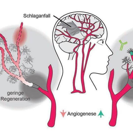 Das Signalmolekül Nogo-A hemmt die Regeneration von Blutgefäßen nach einem Hirnschlag (für mehr Details, bitte auf das Bild klcken). Das Signalmolekül Nogo-A hemmt die Regeneration von Blutgefäßen nach einem Hirnschlag (für mehr Details, bitte auf das Bild klcken).