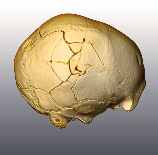 Zwei kleine Narben und eine größere Fraktur verlaufen über den 33.000 Jahre alten Frühmenschen-Schädel, der in der rumänischen Cioclovina-Höhle gefunden wurde. Zwei kleine Narben und eine größere Fraktur verlaufen über den 33.000 Jahre alten Frühmenschen-Schädel, der in der rumänischen Cioclovina-Höhle gefunden wurde.