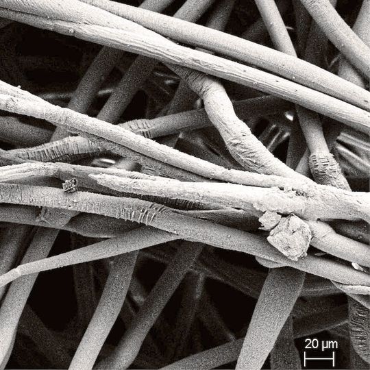 Abb.1: Rasterelektronenmikroskopische Aufnahme einer mit Zinkoxid ausgestatteten Wundauflage Abb.1: Rasterelektronenmikroskopische Aufnahme einer mit Zinkoxid ausgestatteten Wundauflage