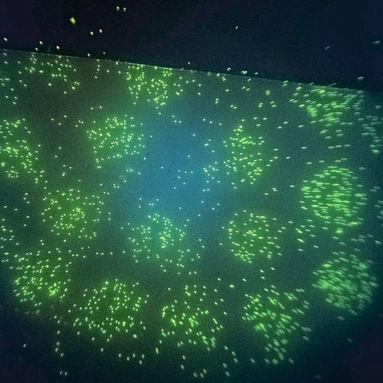Fluoreszierende Legionellen Fluoreszierende Legionellen