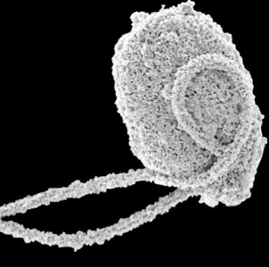 Scanning electron microscope image of Rhodelphis Scanning electron microscope image of Rhodelphis