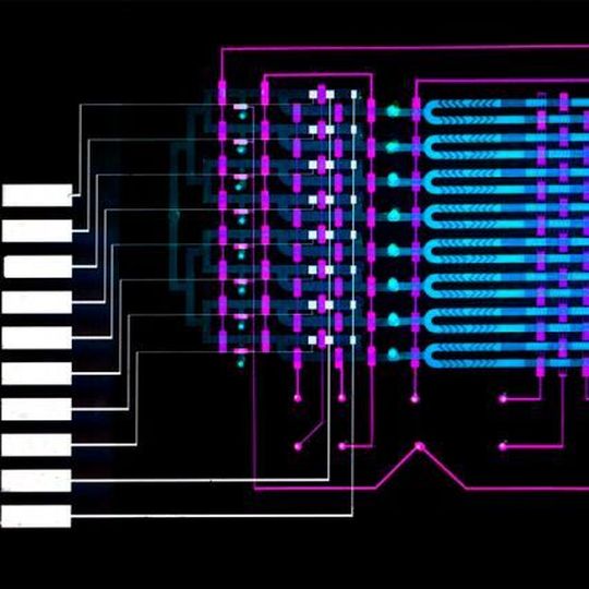 An MIT-invented microfluidics device could help doctors diagnose sepsis, a leading cause of death in U.S. hospitals, by automatically detecting elevated levels of a sepsis biomarker in about 25 minutes, using less than a finger prick of blood. An MIT-invented microfluidics device could help doctors diagnose sepsis, a leading cause of death in U.S. hospitals, by automatically detecting elevated levels of a sepsis biomarker in about 25 minutes, using less than a finger prick of blood.