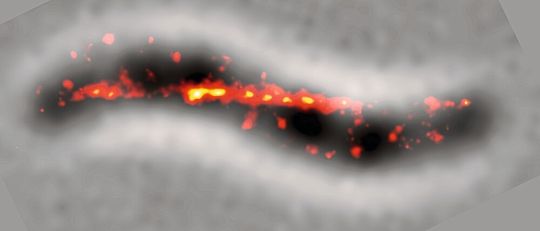 Abb.4: Superauflösende Fluoreszenzmikroskopie lebender Zellen zeigt, wie das MamY-Protein in der Zelle angeordnet ist: Es folgt der stärksten Krümmung der inneren Zelloberfläche.