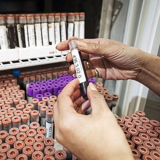 Alternsforscher haben eine Reihe von Biomarkern im menschlichen Blut identifiziert. Alternsforscher haben eine Reihe von Biomarkern im menschlichen Blut identifiziert.