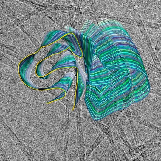 Querschnitt des 3D-Modells einer Amyloidfibrille vor dem Hintergrund einer Kryoelektronenmikroskopie-Aufnahme. Gelb hervorgehoben ist eine PI3K-SH3-Domäne. Querschnitt des 3D-Modells einer Amyloidfibrille vor dem Hintergrund einer Kryoelektronenmikroskopie-Aufnahme. Gelb hervorgehoben ist eine PI3K-SH3-Domäne.