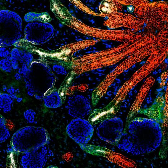 An image of a kidney organoid at Day 24 under confocal microscopy, which shows the preliminary development of structures in a kidney. An image of a kidney organoid at Day 24 under confocal microscopy, which shows the preliminary development of structures in a kidney.