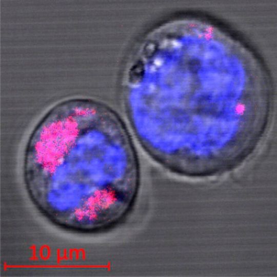 Zwei CD34+-Stammzellen, in denen sich Kohlenstoff-Nanopartikel befinden (magenta gefärbt); in Blau sind die Zellkerne zu sehen. Die Forscher stellten fest, dass die Nanopartikel in den Lysosomen der Zelle eingeschlossen sind. Zwei CD34+-Stammzellen, in denen sich Kohlenstoff-Nanopartikel befinden (magenta gefärbt); in Blau sind die Zellkerne zu sehen. Die Forscher stellten fest, dass die Nanopartikel in den Lysosomen der Zelle eingeschlossen sind.
