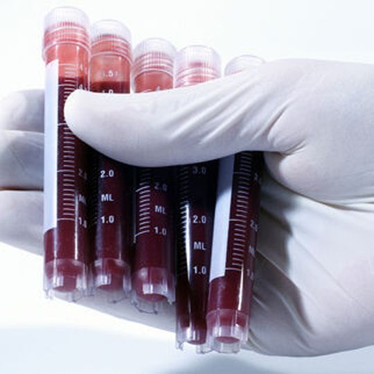 Beim Human-Biomonitoring geht es um die Entwicklung von Methoden, mit denen Chemikalien im menschlichen Körper nachgewiesen und gemessen werden können. Bundesumweltministerium und VCI kooperieren auf diesem Gebiet bereits seit 2010. Beim Human-Biomonitoring geht es um die Entwicklung von Methoden, mit denen Chemikalien im menschlichen Körper nachgewiesen und gemessen werden können. Bundesumweltministerium und VCI kooperieren auf diesem Gebiet bereits seit 2010.
