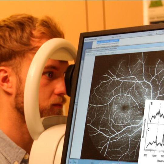 Ein europäisches Forscherteam baut ein Gerät, an dem Patienten ihr Auge berührungsfrei abrastern lassen können und wenige Minuten später eine Diagnose erhalten. Ein europäisches Forscherteam baut ein Gerät, an dem Patienten ihr Auge berührungsfrei abrastern lassen können und wenige Minuten später eine Diagnose erhalten.