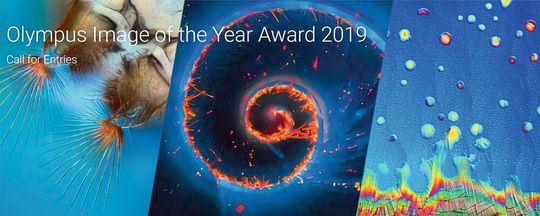 Für lichtmikroskopische Life-Science-Aufnahmen, die zum europaweit ausgeschriebenen Preis „Image of the Year 2018“ eingereicht wurden, schreibt Olympus den globalen Award „Image of the Year Award 2019“ aus. Für lichtmikroskopische Life-Science-Aufnahmen, die zum europaweit ausgeschriebenen Preis „Image of the Year 2018“ eingereicht wurden, schreibt Olympus den globalen Award „Image of the Year Award 2019“ aus.