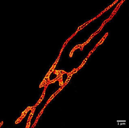 Inner membranes of live mitochondria under a Sted microscope usinig the MitoPB yellow fluorescent marker molecule created by researchers at the Institute of Transformative Bio-Molecules (ITbM) at Nagoya University. Inner membranes of live mitochondria under a Sted microscope usinig the MitoPB yellow fluorescent marker molecule created by researchers at the Institute of Transformative Bio-Molecules (ITbM) at Nagoya University.