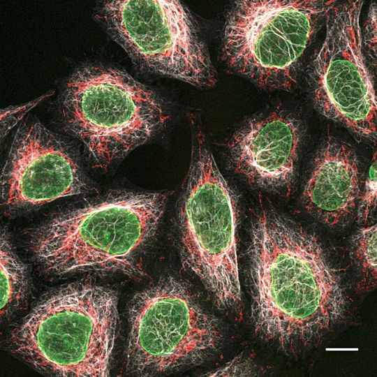 Multiplex Immunofärbung verschiedener Proteine in HeLa Zellen mit drei subklassen-spezifischen Primärantikörpern aus Maus sowie drei subklassen-spezifischen anti-Maus Nano-Secondaries: Grau: Maus IgG1 anti-Vimentin und Alpaka anti-Maus IgG1-VHH Alexa Fluor 647. Grün: Maus IgG2b anti-Lamin A/C und Alpaka anti-Maus IgG2b-VHH Alexa Fluor 488. Rot: Maus IgG3 anti-MOT und Alpaka anti-Maus IgG3-VHH Alexa Fluor 568. Maßstabsbalken: 10 µm. (Die konfokalen Bilder wurden aufgenommen an der zentralen Bioimaging-Einrichtung des Biomedizinischen Zentrum der LMU, München.) Multiplex Immunofärbung verschiedener Proteine in HeLa Zellen mit drei subklassen-spezifischen Primärantikörpern aus Maus sowie drei subklassen-spezifischen anti-Maus Nano-Secondaries: Grau: Maus IgG1 anti-Vimentin und Alpaka anti-Maus IgG1-VHH Alexa Fluor 647. Grün: Maus IgG2b anti-Lamin A/C und Alpaka anti-Maus IgG2b-VHH Alexa Fluor 488. Rot: Maus IgG3 anti-MOT und Alpaka anti-Maus IgG3-VHH Alexa Fluor 568. Maßstabsbalken: 10 µm. (Die konfokalen Bilder wurden aufgenommen an der zentralen Bioimaging-Einrichtung des Biomedizinischen Zentrum der LMU, München.)