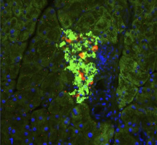 A pancreatic islet of an insulin deficient mouse (cells producing insulin are virtually absent). A pancreatic islet of an insulin deficient mouse (cells producing insulin are virtually absent).