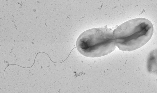 Mit seiner einzelnen polaren Flagelle kann sich Vibrio parahaemolyticus schwimmend im Meerwasser fortbewegen. Die Aufnahme zeigt eine sich teilende Zelle, was an der Einschnürung der Zellmitte erkennbar ist. Mit seiner einzelnen polaren Flagelle kann sich Vibrio parahaemolyticus schwimmend im Meerwasser fortbewegen. Die Aufnahme zeigt eine sich teilende Zelle, was an der Einschnürung der Zellmitte erkennbar ist.
