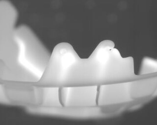 In-Production-Test: Mit konventionellen visuellen Prüfmethoden sind manche Fehler nur schwer oder gar nicht zu entdecken. Mit der Thermoinspektion verfolgt Vision & Control einen neuartigen Ansatz mittels Wärmebildkamera. Im Wärmebild fällt der unvollständig gefüllte Zahn sofort ins Auge. In-Production-Test: Mit konventionellen visuellen Prüfmethoden sind manche Fehler nur schwer oder gar nicht zu entdecken. Mit der Thermoinspektion verfolgt Vision & Control einen neuartigen Ansatz mittels Wärmebildkamera. Im Wärmebild fällt der unvollständig gefüllte Zahn sofort ins Auge.