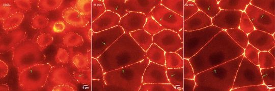 Entstehung der Gewebebarriere: Ein Protein, nötig für die Herstellung der Gewebebarriere, wurde mit fluoreszierendem Farbstoff markiert und mithilfe von Fluoreszenzmikroskopie live verfolgt. Entstehung der Gewebebarriere: Ein Protein, nötig für die Herstellung der Gewebebarriere, wurde mit fluoreszierendem Farbstoff markiert und mithilfe von Fluoreszenzmikroskopie live verfolgt.