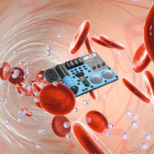 Point-of-Care-Cartridges können gerade bei labordiagnostische Anwendungen wie der Blutanalyse ihre Vorteile ausspielen. Point-of-Care-Cartridges können gerade bei labordiagnostische Anwendungen wie der Blutanalyse ihre Vorteile ausspielen.