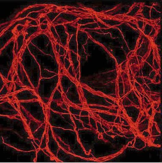 Organoidmodelle mit einer teils verblüffenden Ähnlichkeit zu echten embryonalen Geweben: 3D-Rekonstruktion des Blutgefäßsystems innerhalb eines Organoids Organoidmodelle mit einer teils verblüffenden Ähnlichkeit zu echten embryonalen Geweben: 3D-Rekonstruktion des Blutgefäßsystems innerhalb eines Organoids