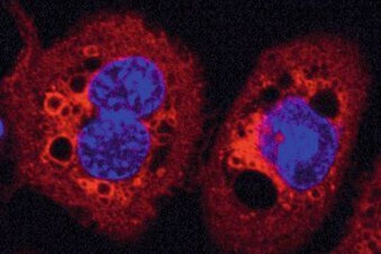 Pseudomonas aeruginosa-Lektin LecB kann den Zellzyklus blockieren. Pseudomonas aeruginosa-Lektin LecB kann den Zellzyklus blockieren.