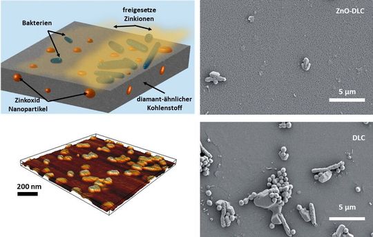 Eine „intelligente“ Beschichtung aus diamantähnlichem Kohlenstoff mit eingebetteten Zinkoxid-Nanopartikeln soll Infektionen auf Prothesen verringern (Details: s. Ergänzendes zum Thema). Eine „intelligente“ Beschichtung aus diamantähnlichem Kohlenstoff mit eingebetteten Zinkoxid-Nanopartikeln soll Infektionen auf Prothesen verringern (Details: s. Ergänzendes zum Thema).