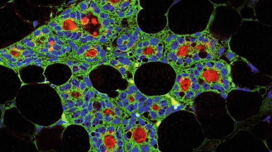 Schnitt durch eine Milchdrüse, die von dentalen Stammzellen erzeugt wurde (grün: Zahnepithelzellen, blau: Zellkerne, rot: milchspezifisches Protein Kasein) Schnitt durch eine Milchdrüse, die von dentalen Stammzellen erzeugt wurde (grün: Zahnepithelzellen, blau: Zellkerne, rot: milchspezifisches Protein Kasein)