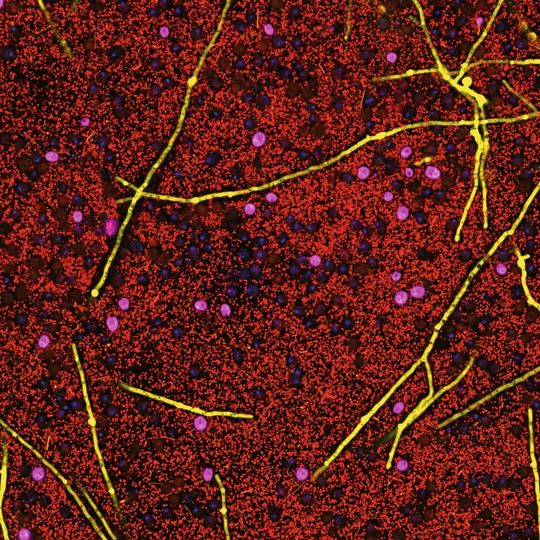 Das Darmmikrobiom bestimmt, bei welchen Patienten Bewegung positive Effekte bei der Diabetesvorbeugung hat. Das Darmmikrobiom bestimmt, bei welchen Patienten Bewegung positive Effekte bei der Diabetesvorbeugung hat.