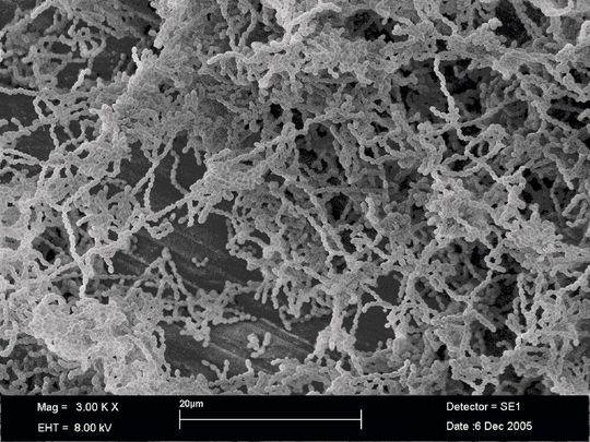 Auch der Hauptverursacher von Karies, Streptococcus mutans, kann Resistenzen gegen das Antiseptikum Chlorhexidin bilden. Auch der Hauptverursacher von Karies, Streptococcus mutans, kann Resistenzen gegen das Antiseptikum Chlorhexidin bilden.